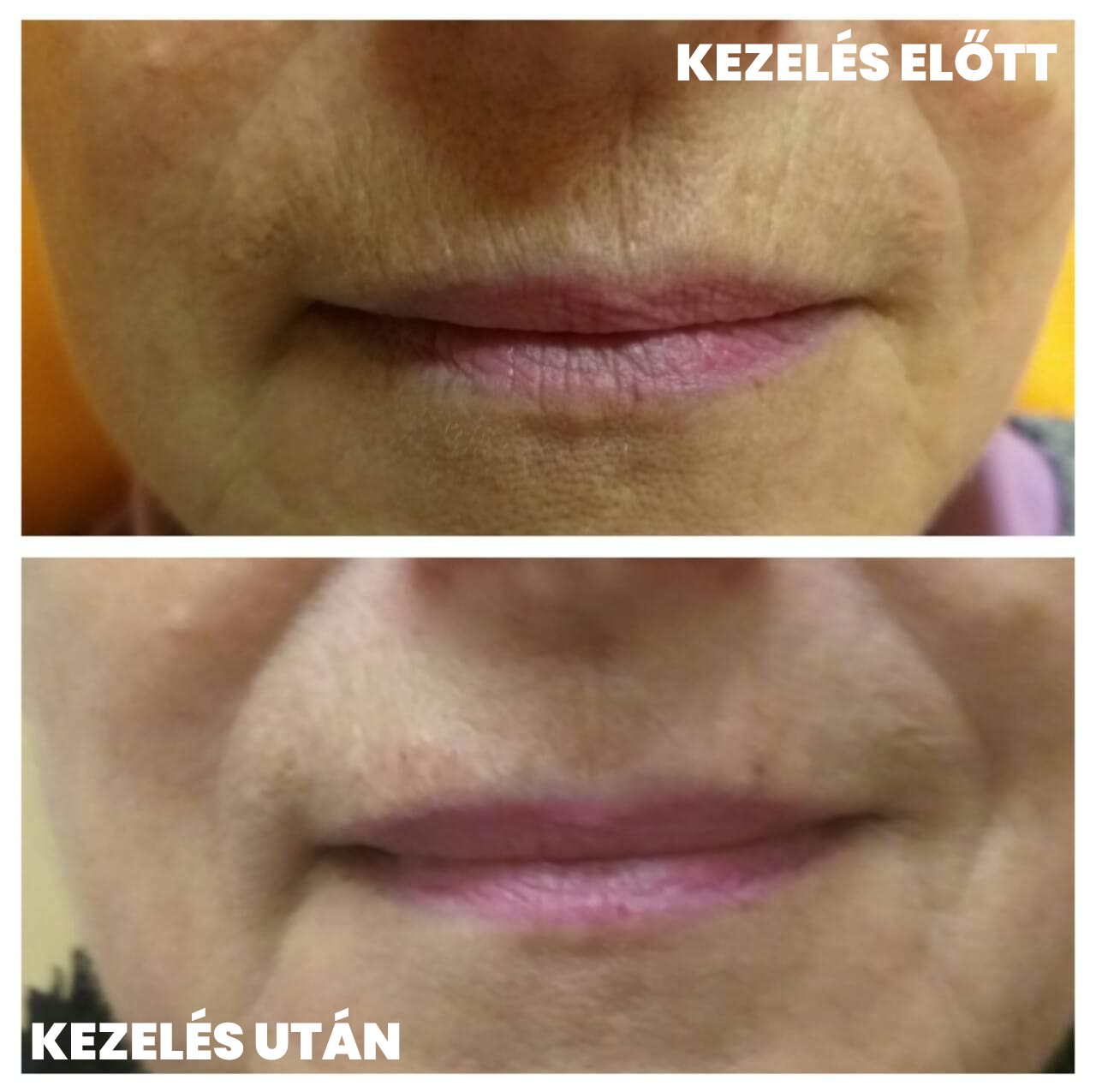 dohányránc feltöltése debrecenben