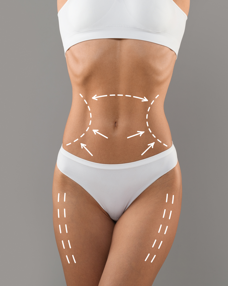 kép_2023-07-20_112349037