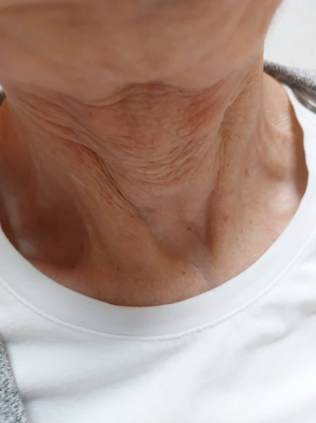 received_155424360525008