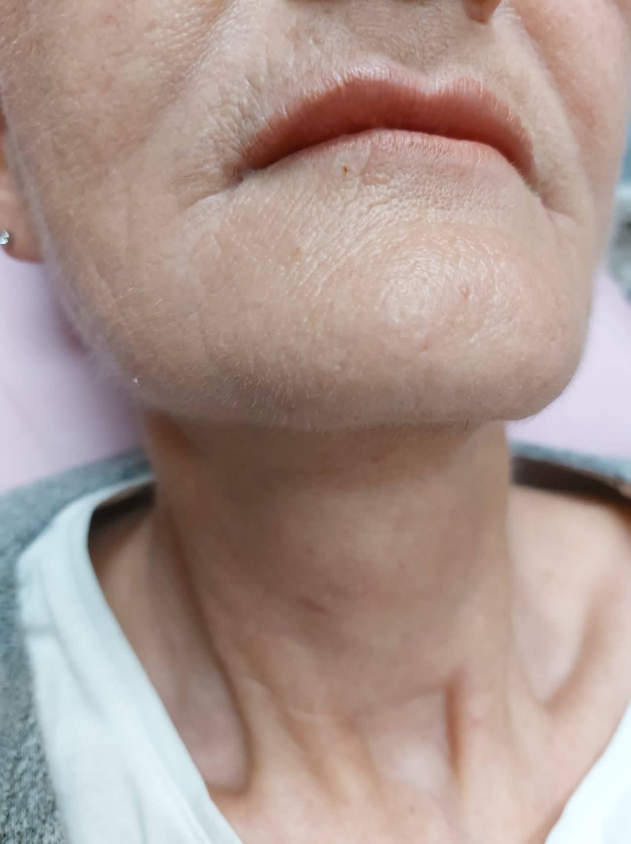 received_248046127623711