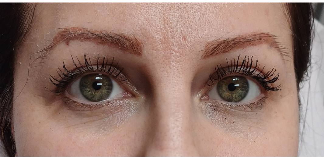 szemkönyéki1-kész